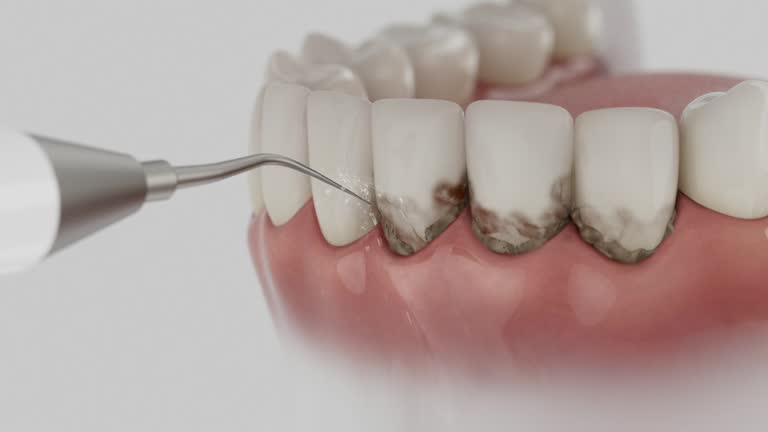Trusted Dental Crowns And Bridges service in Hot Springs Village, AR - Dentist Open Now